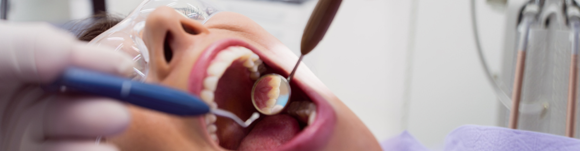 Dentist using a mirror to examine teeth for signs of early tooth decay.